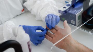Koronavirüs sonrası antikor seviyeleri ‘hızla düşüyor’